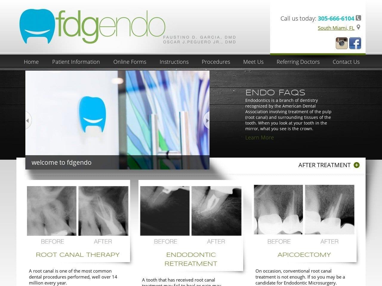 FDGEndo