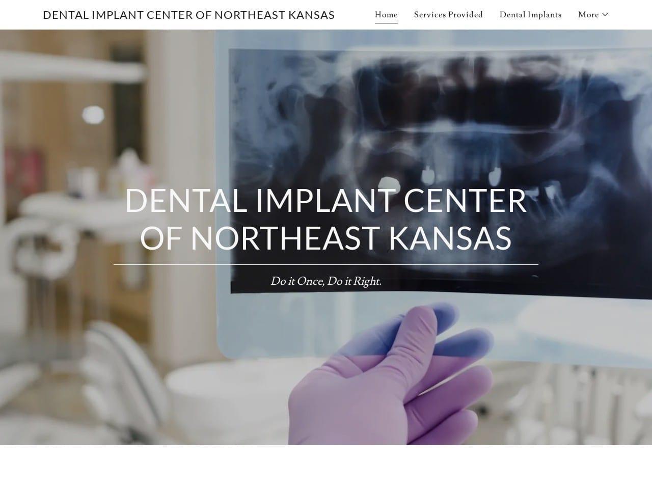 Dental Implant Center